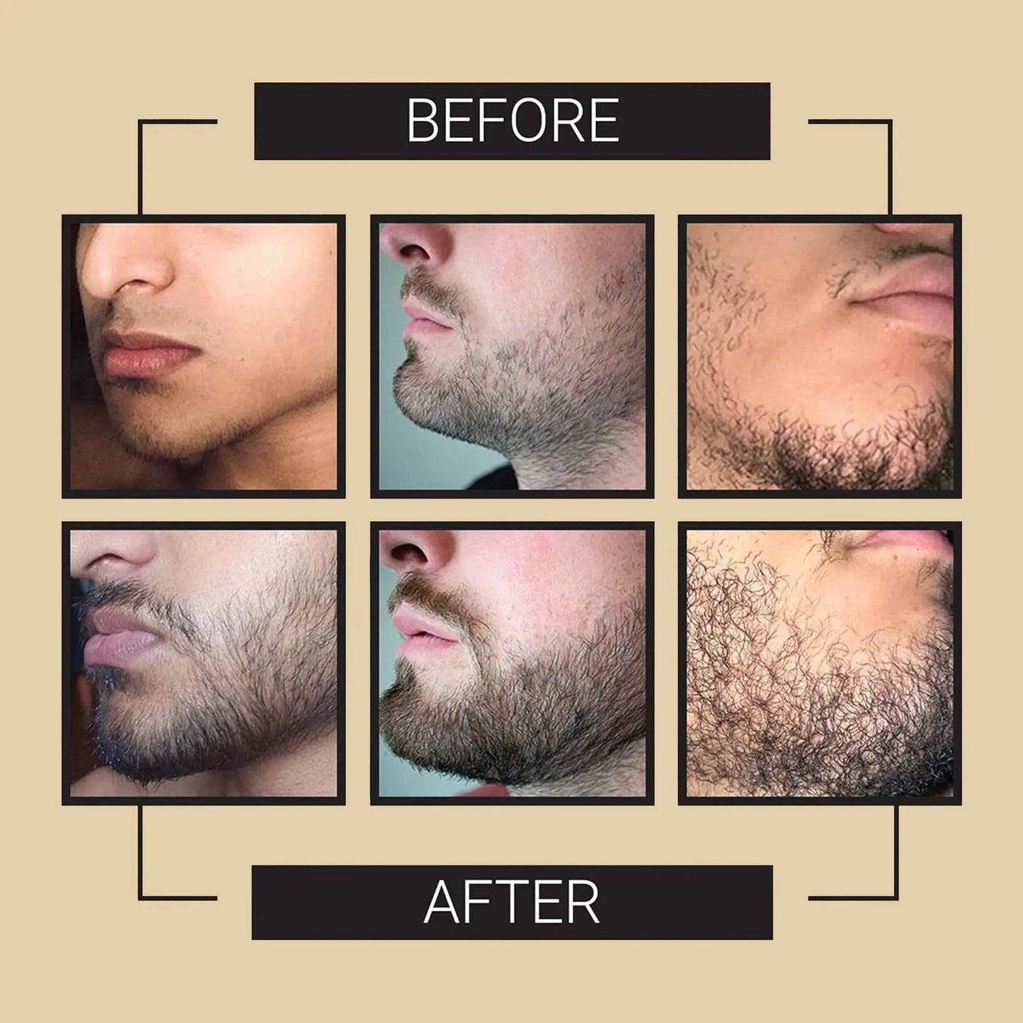 Beard Growth Serum - Crafted Beards