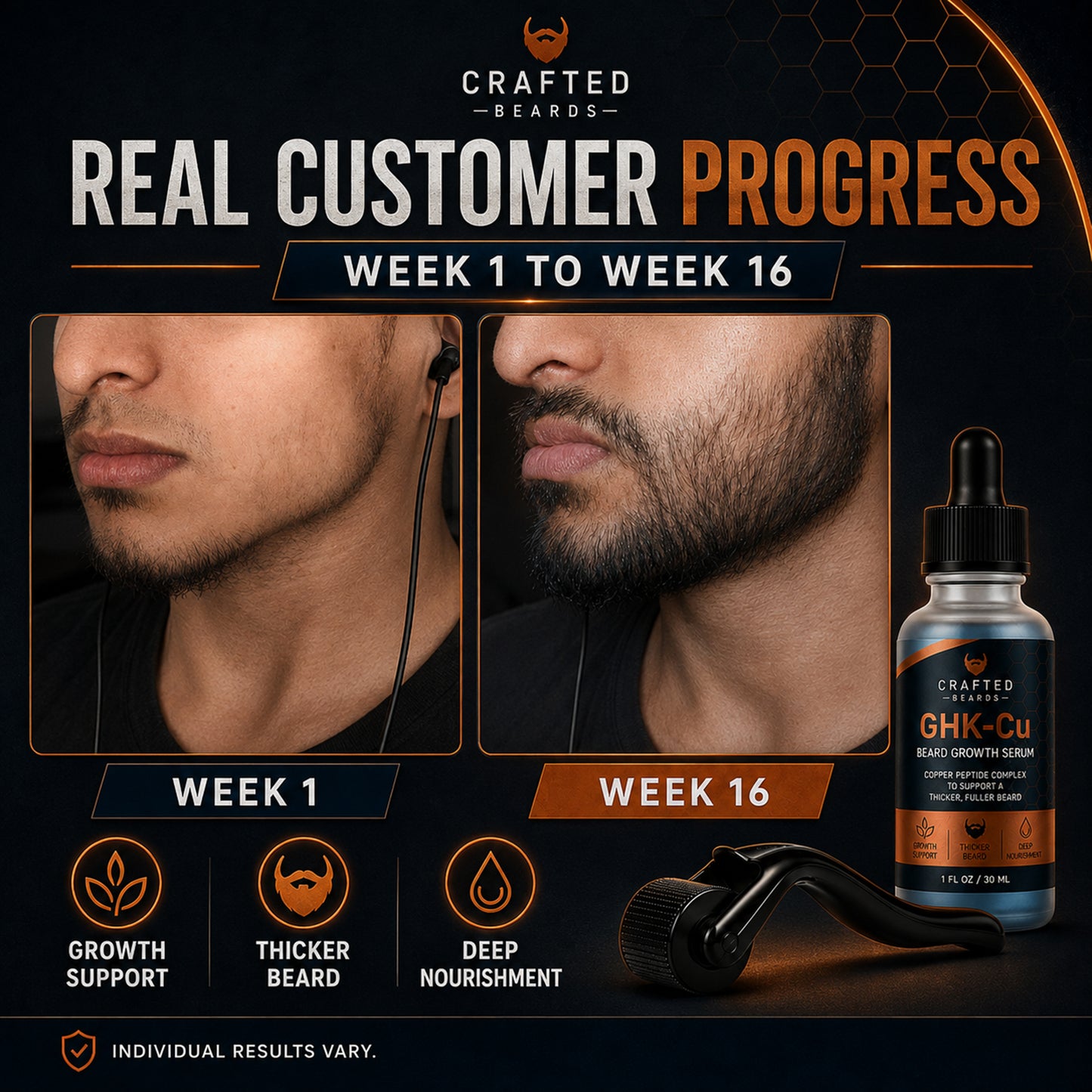 Beard Growth Kit