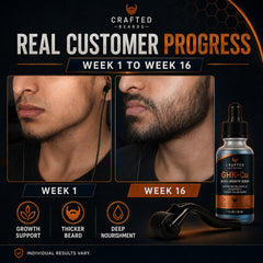 Customer beard growth results from the Crafted Beards growth kit
