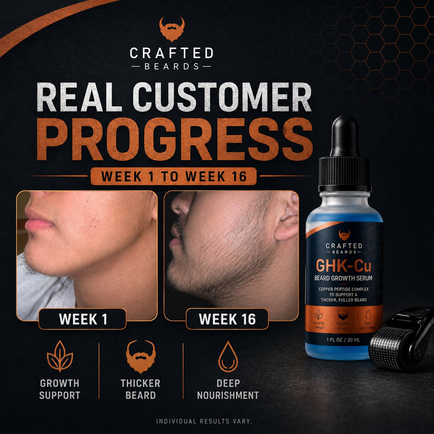 Beard Growth Kit