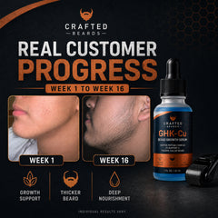Before and after beard growth results with denser-looking coverage