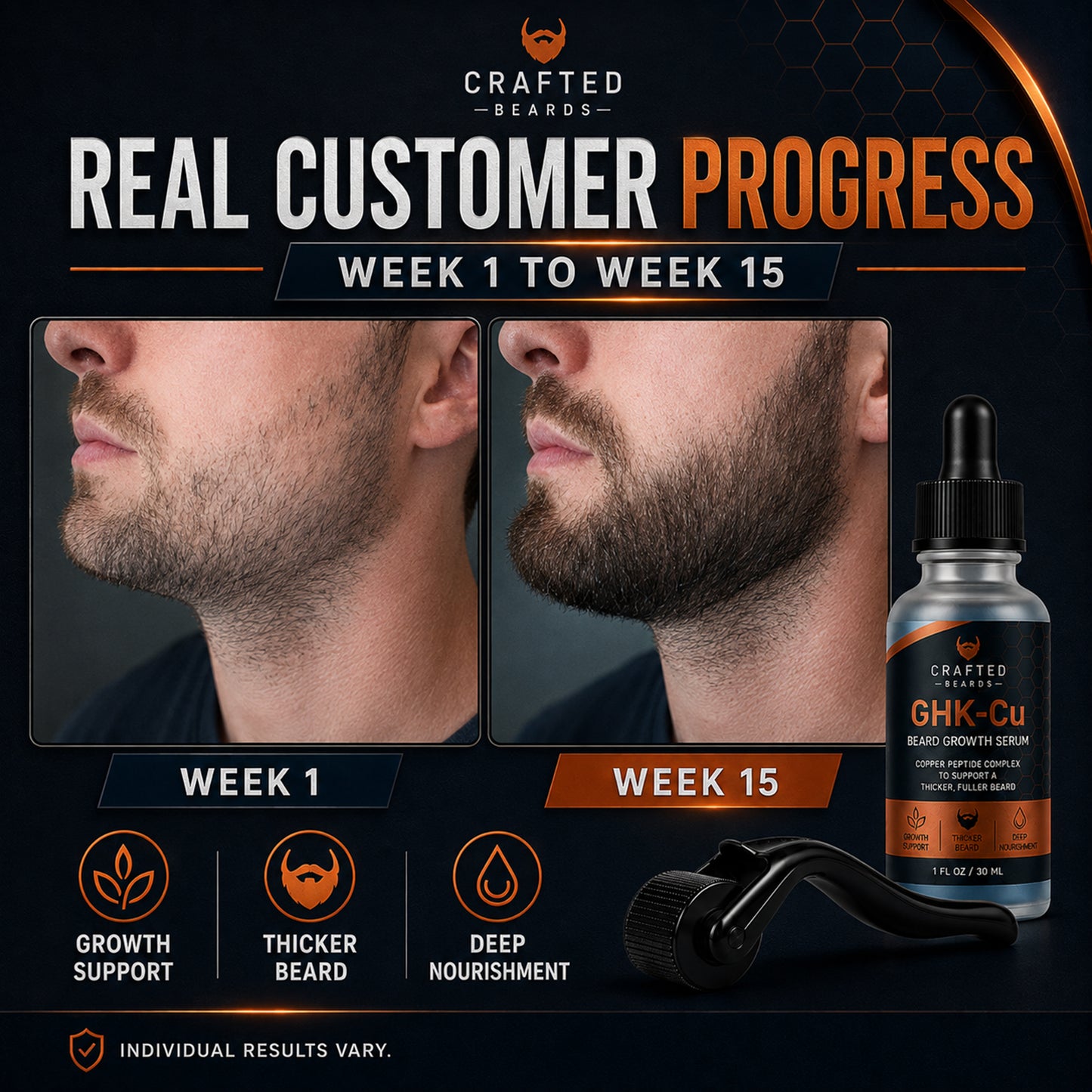 Beard Growth Kit
