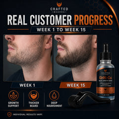 Beard growth before and after showing fuller-looking facial hair coverage