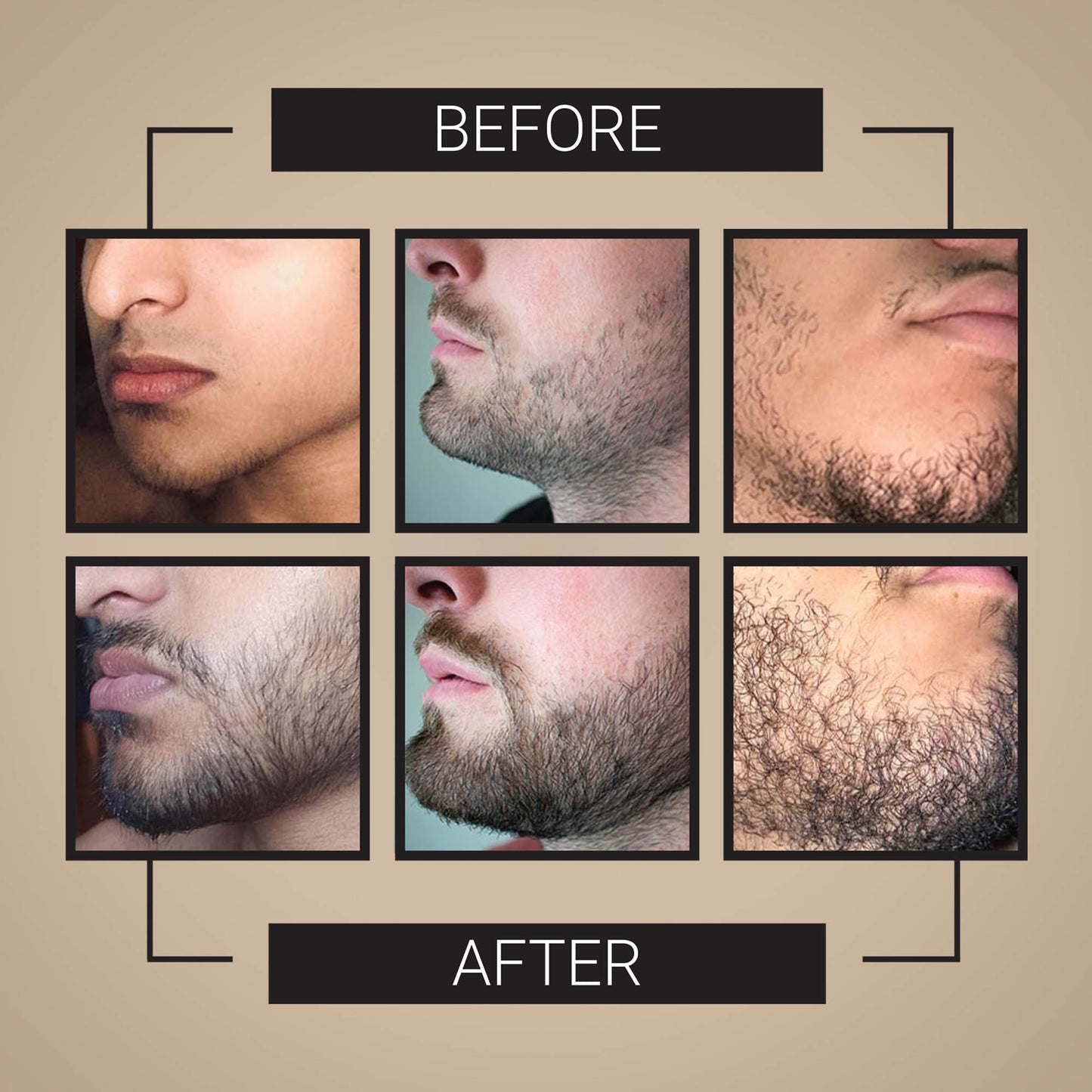 Beard Growth Serum - Crafted Beards