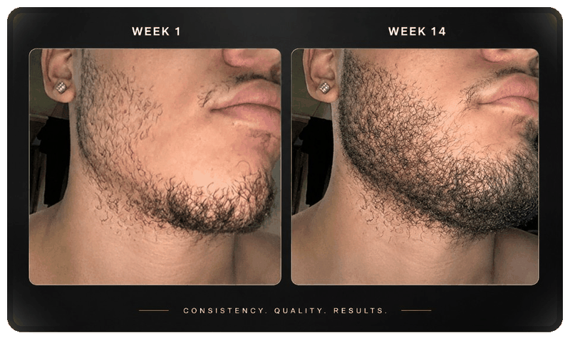 Week 1 vs Week 14 beard progress