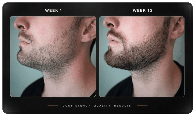 Before and after beard progress