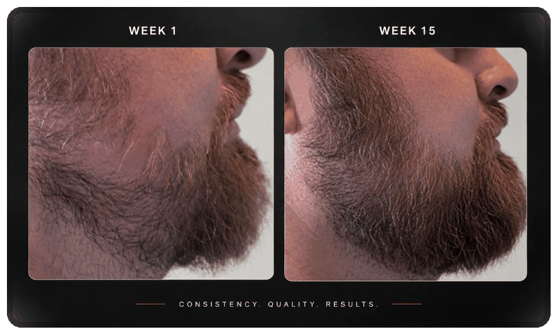 Before and after beard progress