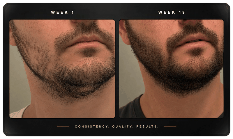 Before and after beard progress