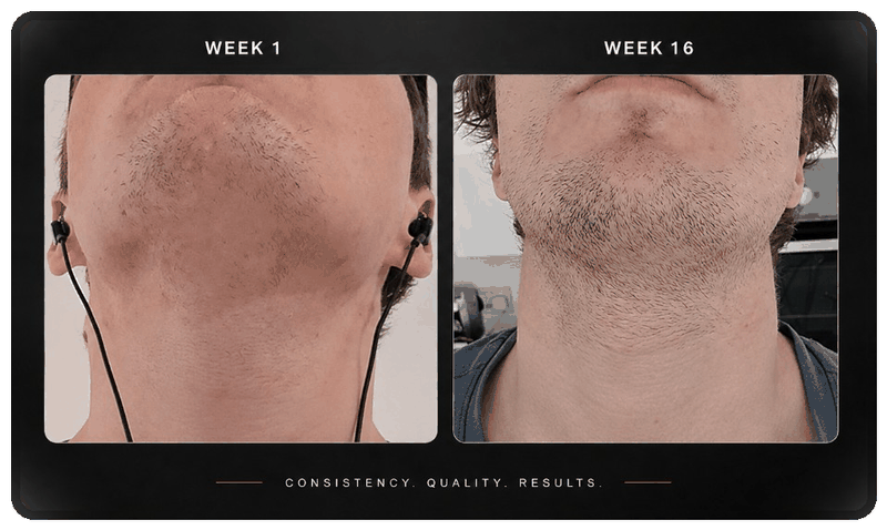 Before and after beard progress
