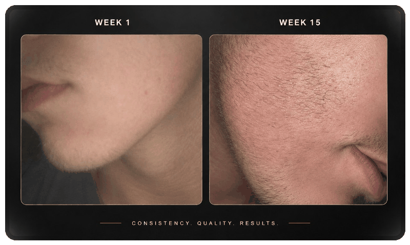 Before and after beard progress