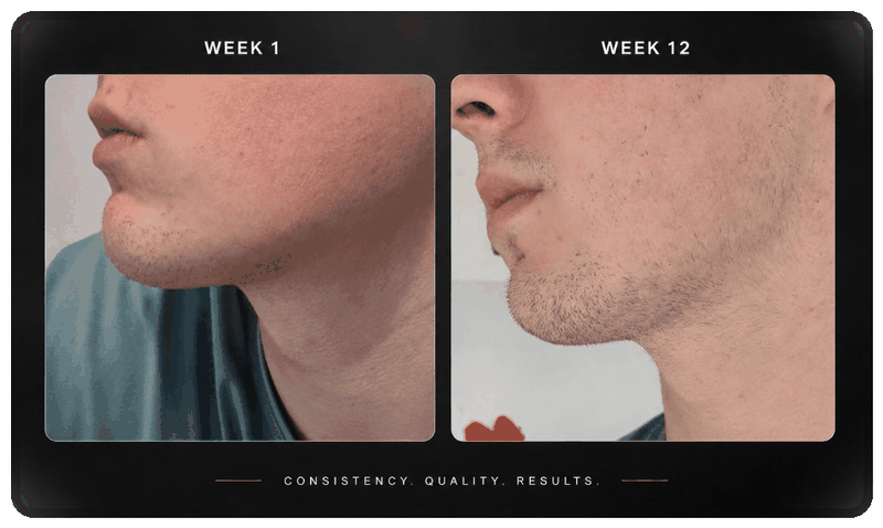 Before and after beard progress