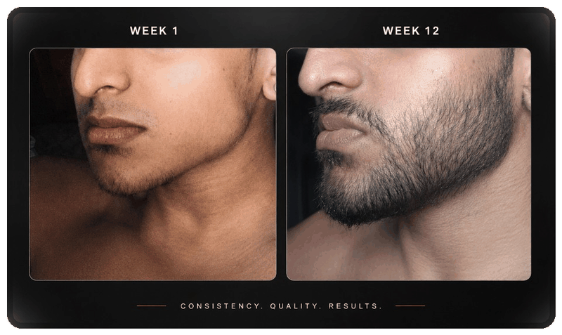 Before and after beard progress